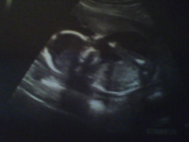 Name:  Snapshot_20121102.JPG
Views: 141
Size:  28.9 KB