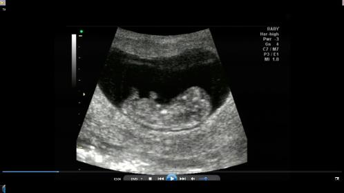Name:  baby.jpg
Views: 266
Size:  13.3 KB