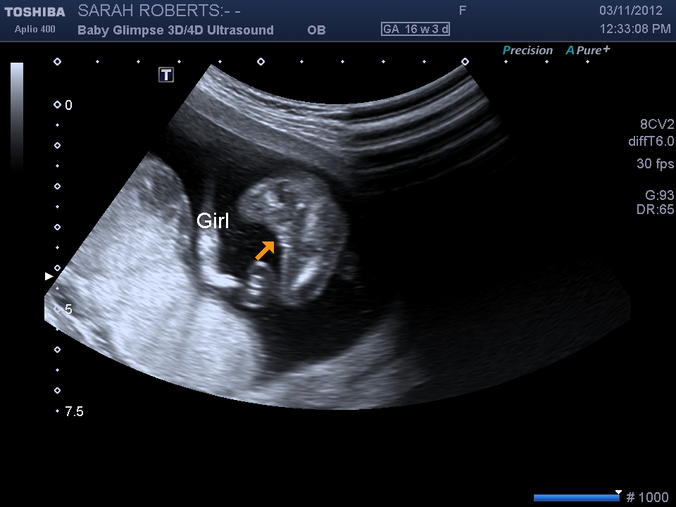 Name:  I201211031241030266.jpg
Views: 189
Size:  230.4 KB