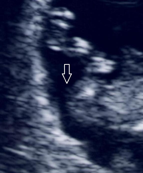 Name:  Baby B 5.jpg
Views: 76
Size:  56.1 KB