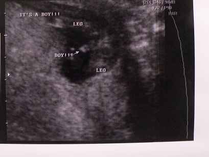 Name:  baby110312.JPG
Views: 217
Size:  52.5 KB
