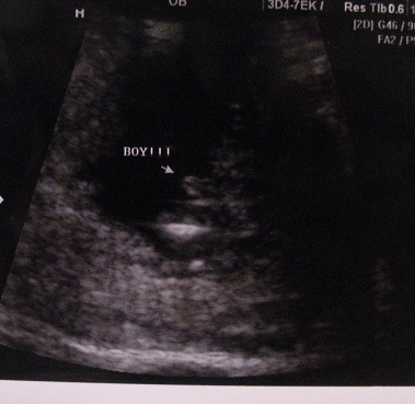 Name:  baby1103122.JPG
Views: 204
Size:  51.5 KB