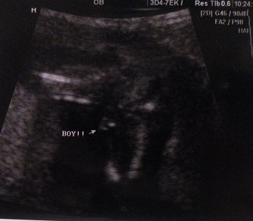 Name:  baby1103123.JPG
Views: 184
Size:  44.2 KB