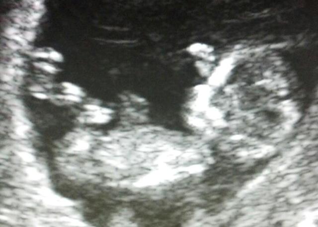 Name:  Baby B web.jpg
Views: 180
Size:  37.6 KB
