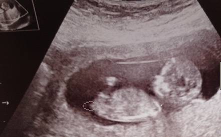 Name:  Picture4.jpg
Views: 139
Size:  15.7 KB