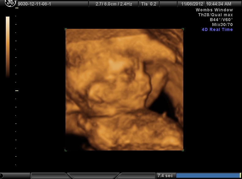 Name:  B_10.JPG
Views: 1201
Size:  89.3 KB