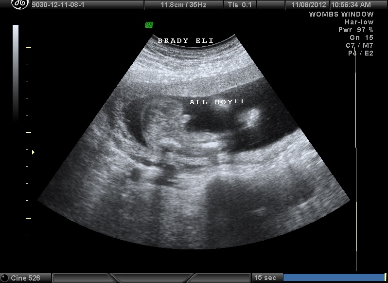 Name:  B_22.JPG
Views: 1187
Size:  155.0 KB