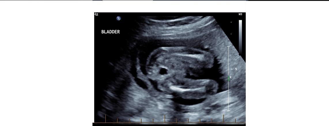 Name:  Bladder shot.jpg
Views: 646
Size:  36.3 KB
