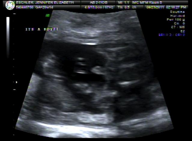 Name:  baby boy 2.jpg
Views: 1275
Size:  28.9 KB