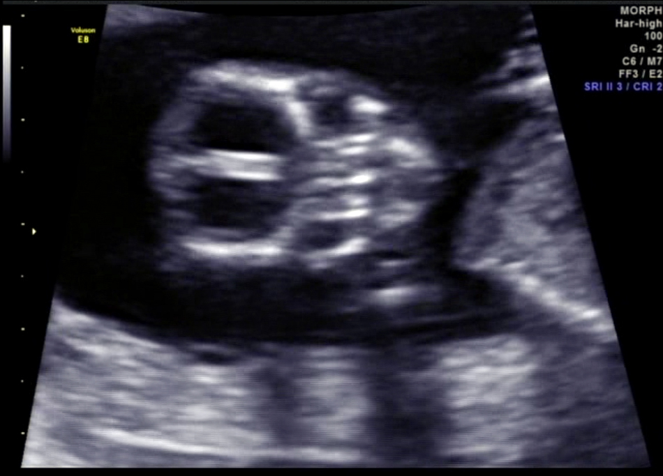 Name:  front-face.jpg
Views: 205
Size:  246.6 KB