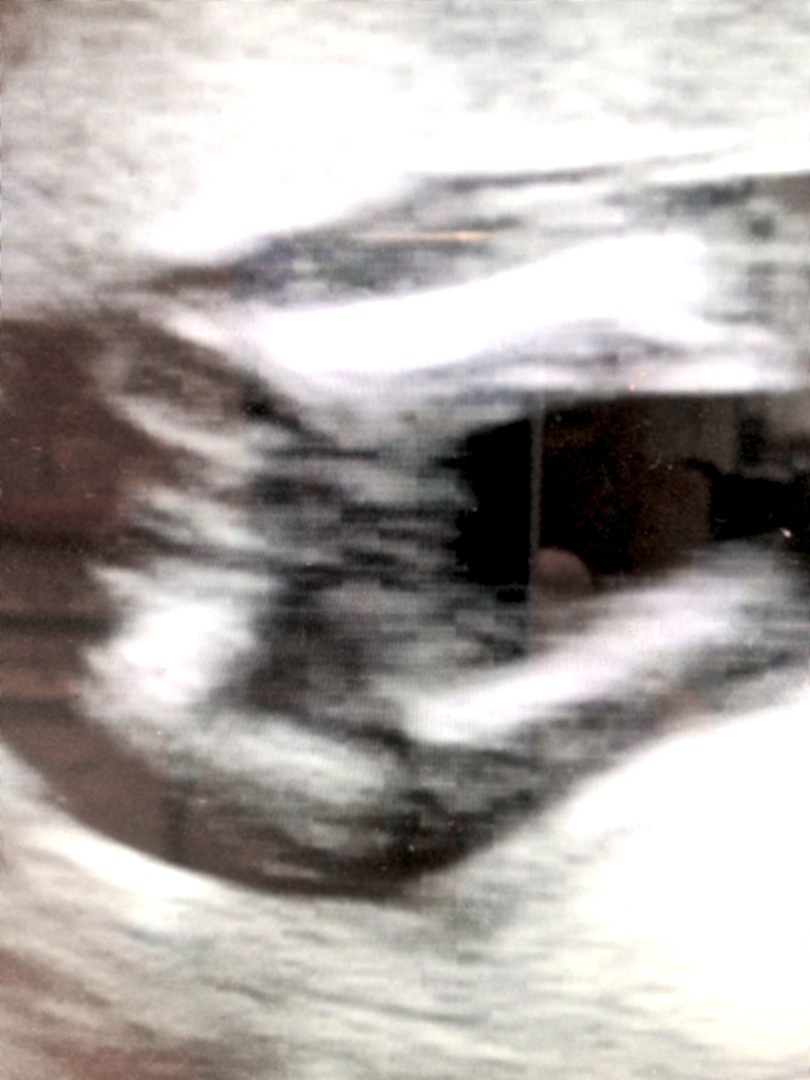 Name:  15 week 14.jpg
Views: 355
Size:  139.3 KB