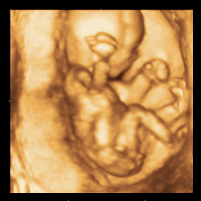 Name:  x14w4dBABY GIRL_0033.JPG
Views: 3355
Size:  166.5 KB