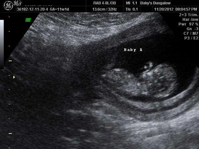 Name:  Baby A.jpg
Views: 913
Size:  48.5 KB