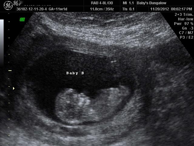 Name:  Baby B.jpg
Views: 883
Size:  48.9 KB