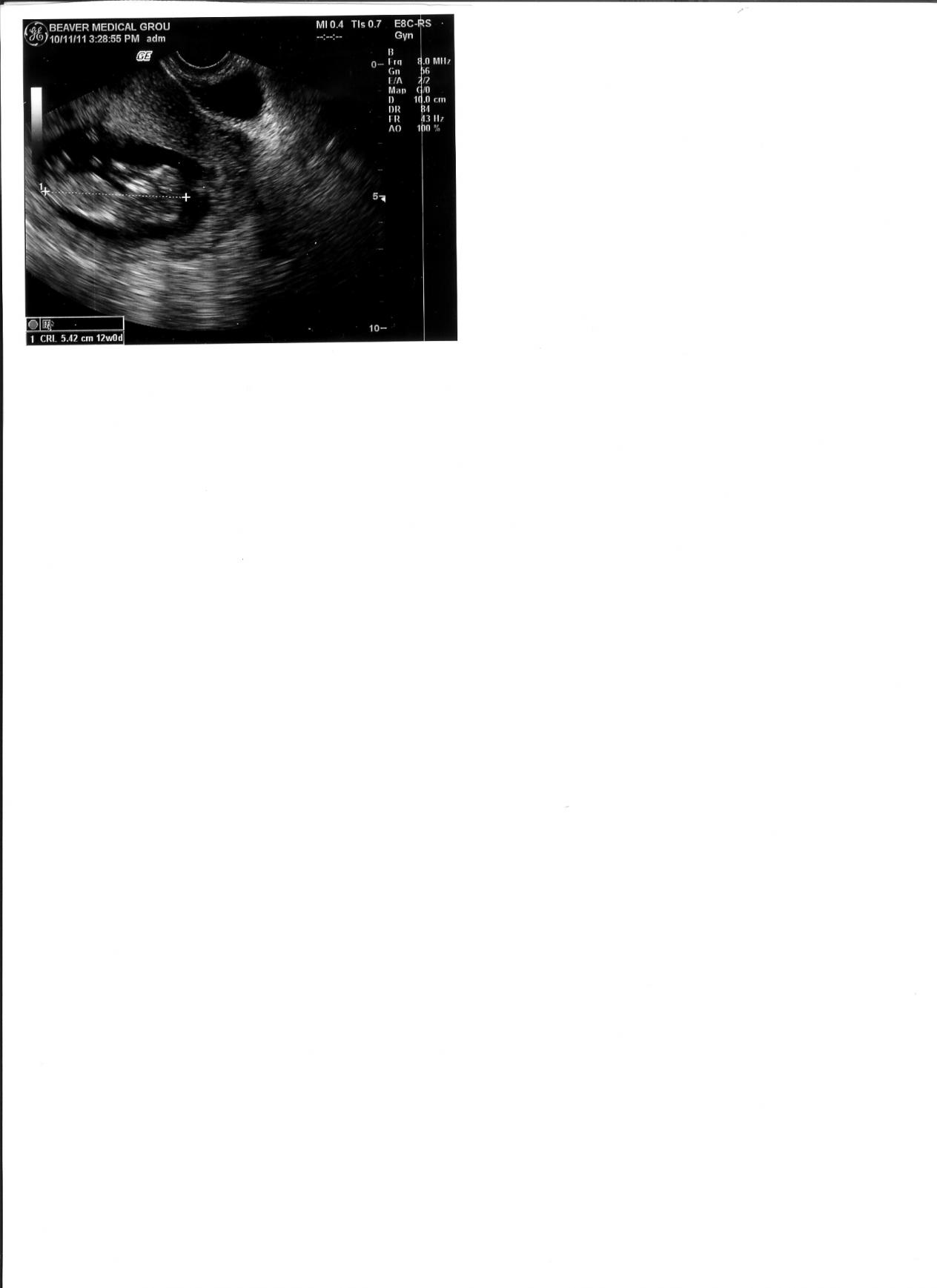 Name:  baby3.jpg
Views: 181
Size:  76.4 KB