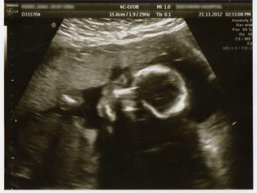 Name:  20scan.jpg
Views: 111
Size:  14.7 KB