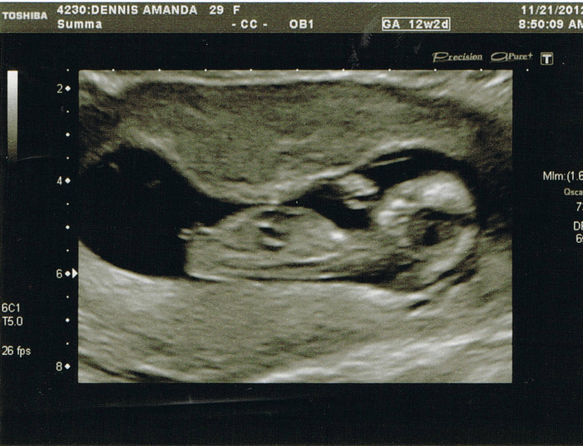 Name:  12 weeks 3.jpg
Views: 542
Size:  738.5 KB
