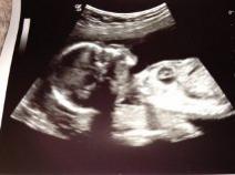 Name:  20 week.jpg
Views: 139
Size:  6.6 KB