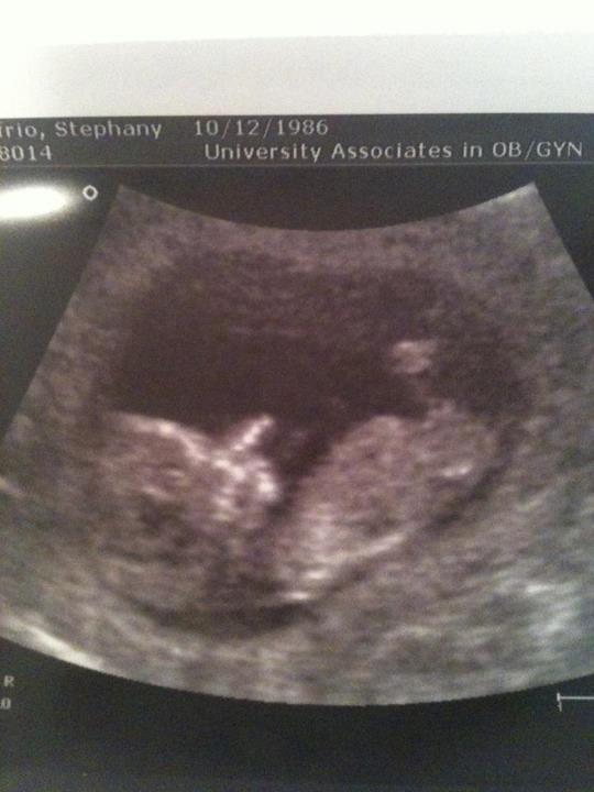 Name:  baby.jpg
Views: 155
Size:  38.6 KB