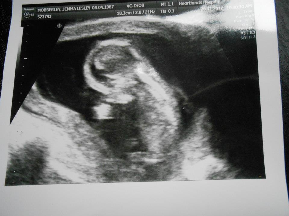 Name:  baby.jpg
Views: 239
Size:  70.2 KB