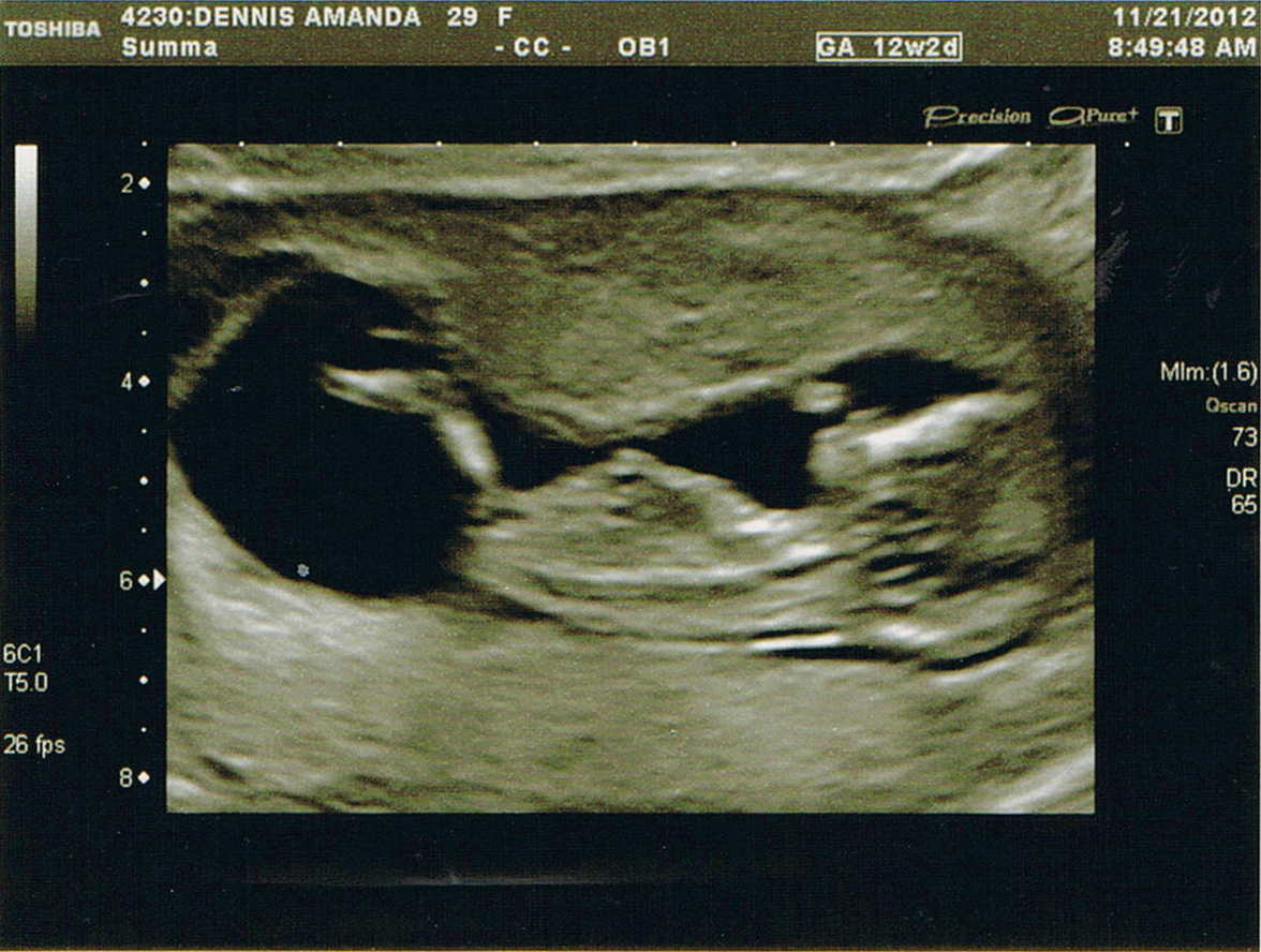 Name:  12 weeks 2.jpg
Views: 159
Size:  812.0 KB