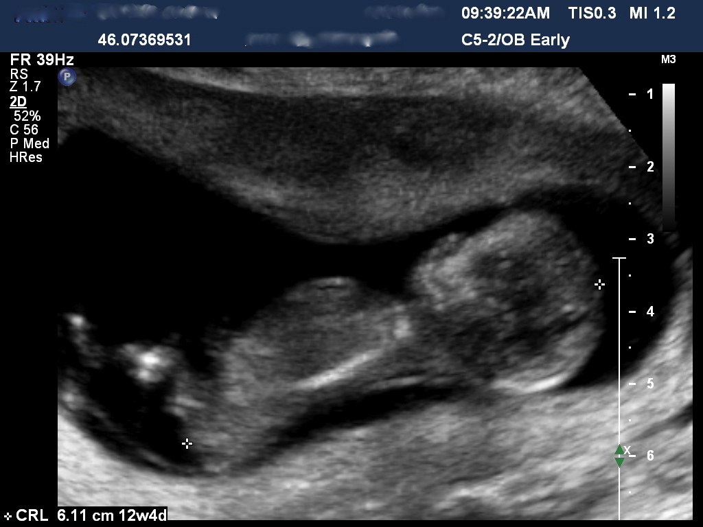 Name:  BAKERANGIE20121123093922929.jpg
Views: 1217
Size:  178.4 KB
