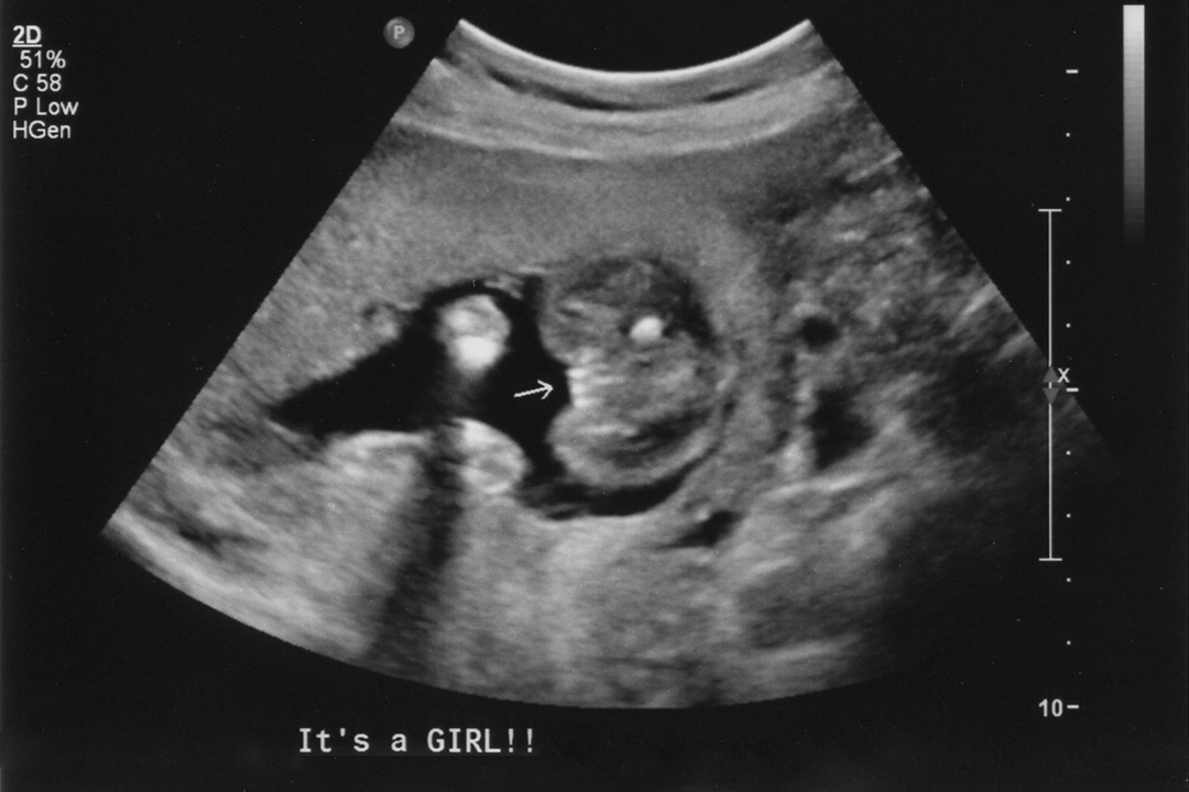 Name:  pottyshot20 weeks.jpg
Views: 12345
Size:  341.6 KB