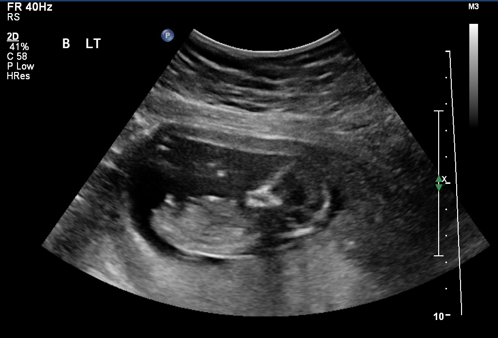 Name:  Baby B nub shot(1).jpg
Views: 1669
Size:  191.8 KB