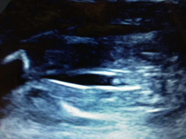 Name:  baby 1.jpg
Views: 223
Size:  102.6 KB