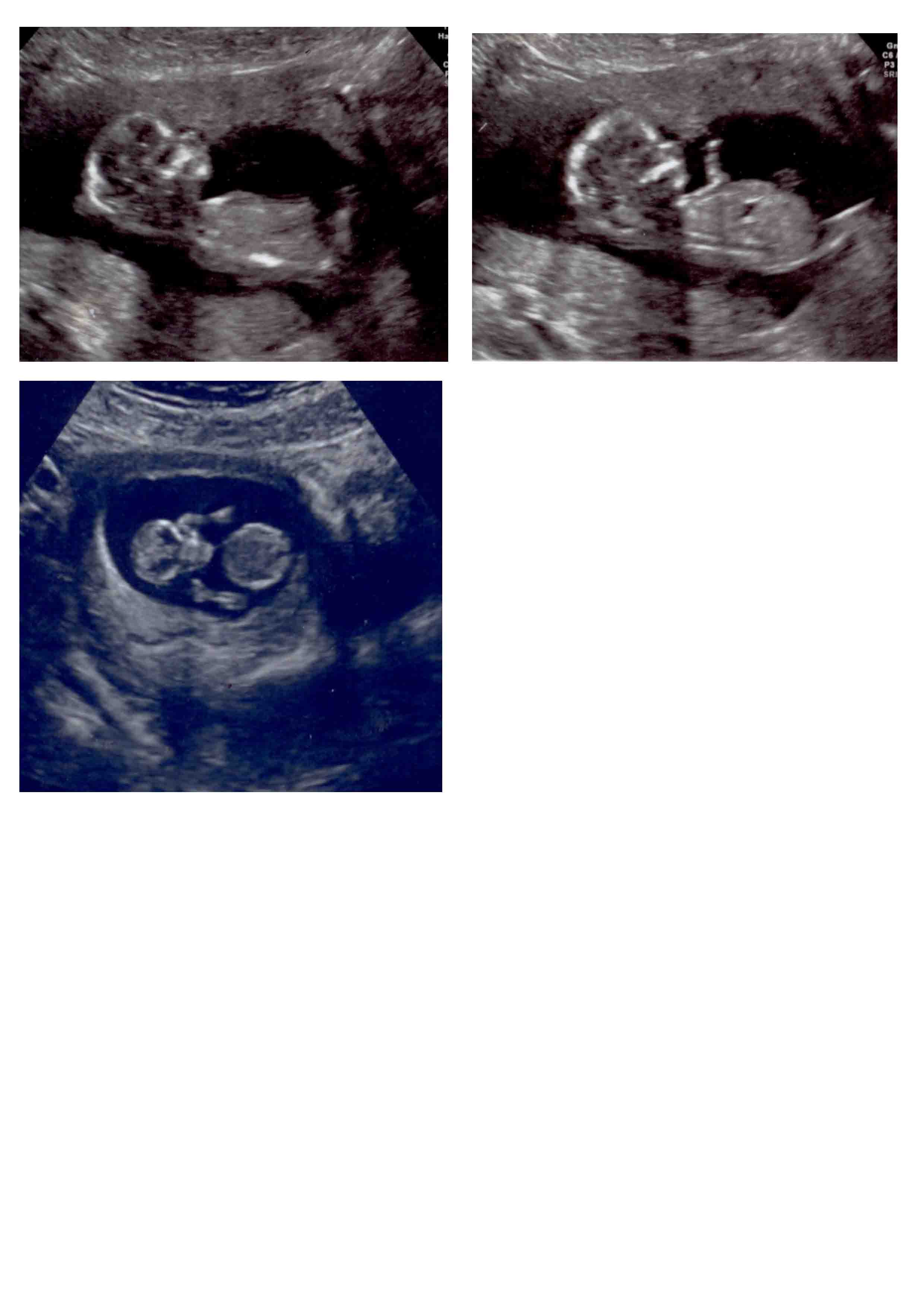 Name:  gender scan.jpg
Views: 479
Size:  172.8 KB