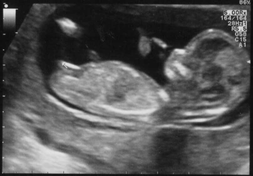 Name:  3dec12-4-12w-12w4d-small.jpg
Views: 213
Size:  27.6 KB