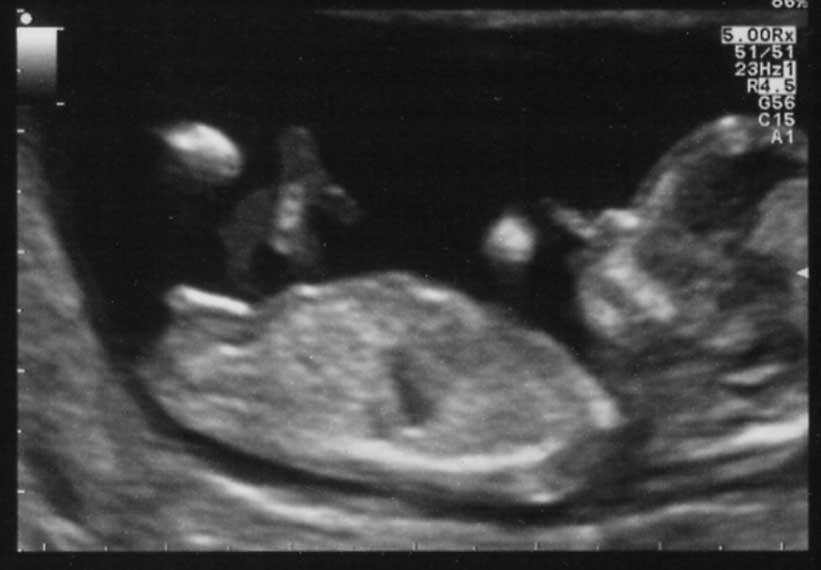 Name:  3dec12-8-12w-12w4d-small.jpg
Views: 203
Size:  24.3 KB