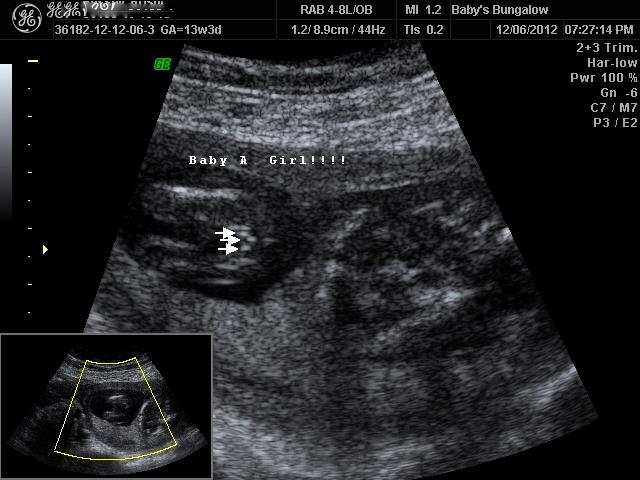 Name:  Baby A - GIRL(2).jpg
Views: 343
Size:  48.1 KB