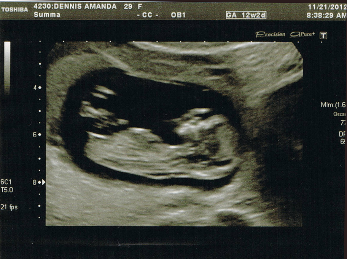 Name:  12 weeks 4.jpg
Views: 159
Size:  679.6 KB