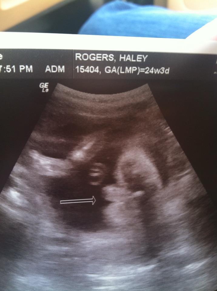 Name:  baby boy Madden.jpg
Views: 1116
Size:  58.7 KB