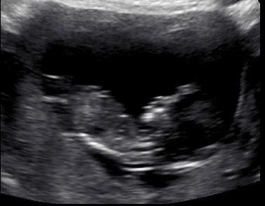 Name:  bub.JPG
Views: 166
Size:  23.4 KB