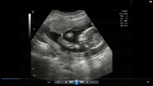 Name:  pottyshot3.jpg
Views: 204
Size:  14.1 KB