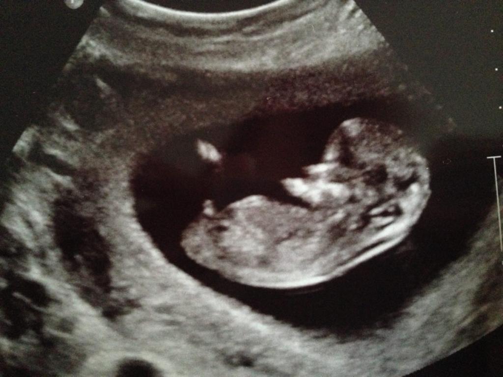 Name:  13wks.jpg
Views: 245
Size:  85.6 KB