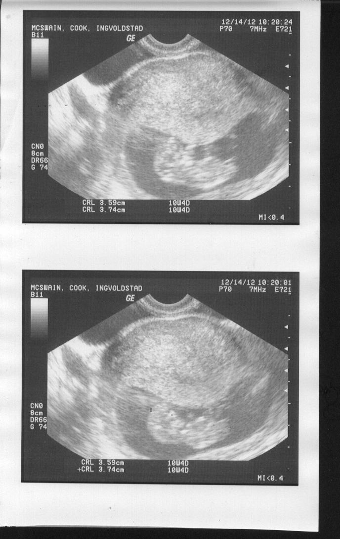 Name:  Ultrasound.jpg
Views: 230
Size:  92.7 KB