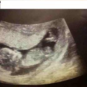 Name:  bump.jpg
Views: 232
Size:  11.0 KB