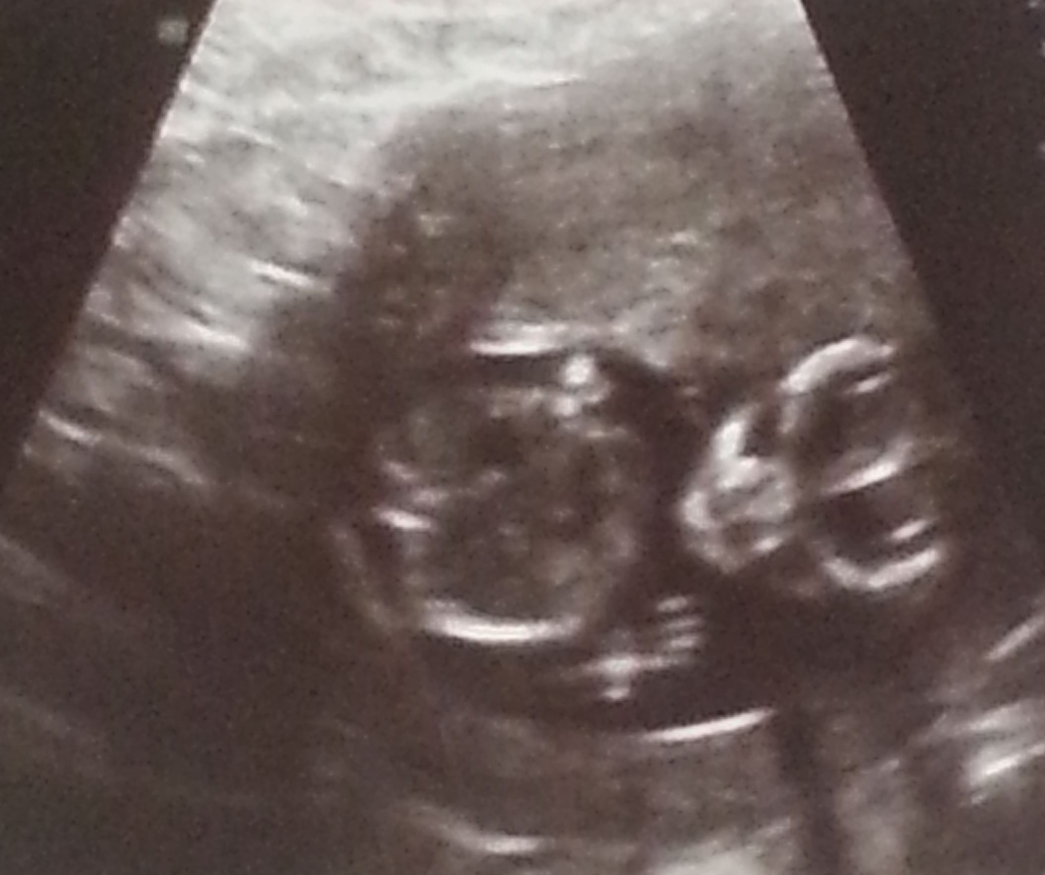 Name:  14wks b1.jpg
Views: 166
Size:  187.3 KB