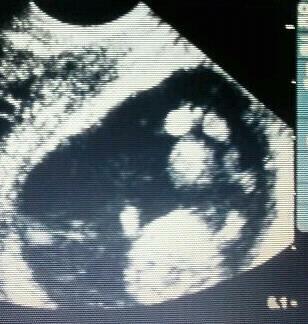 Name:  first ultrasound... dec.7.2012.jpg
Views: 113
Size:  22.5 KB