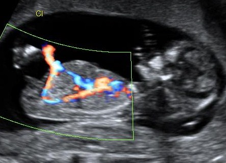Name:  12weekscan 038.jpg
Views: 110
Size:  42.9 KB
