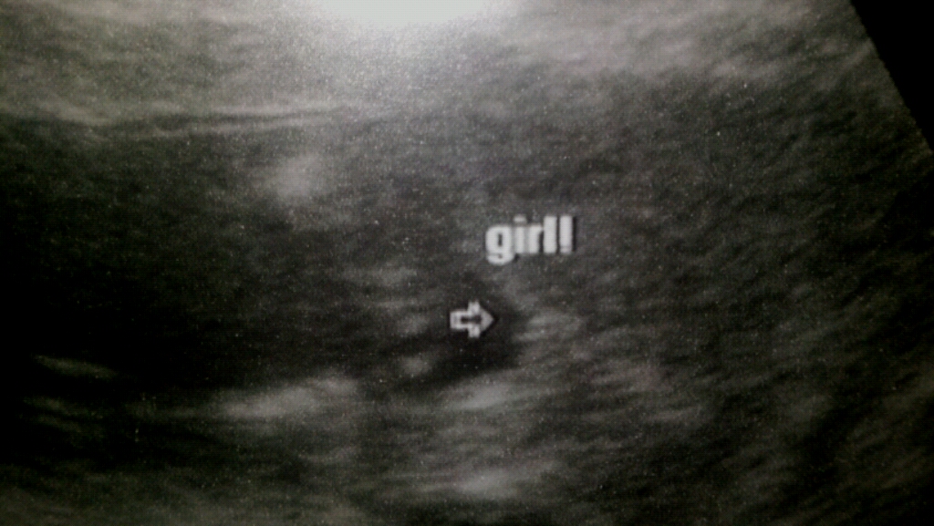 Name:  girl!.jpg
Views: 237
Size:  426.1 KB
