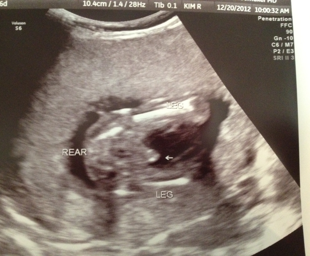 Name:  babyboy.JPG
Views: 142
Size:  460.9 KB