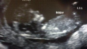 Name:  baby.jpg
Views: 157
Size:  10.0 KB