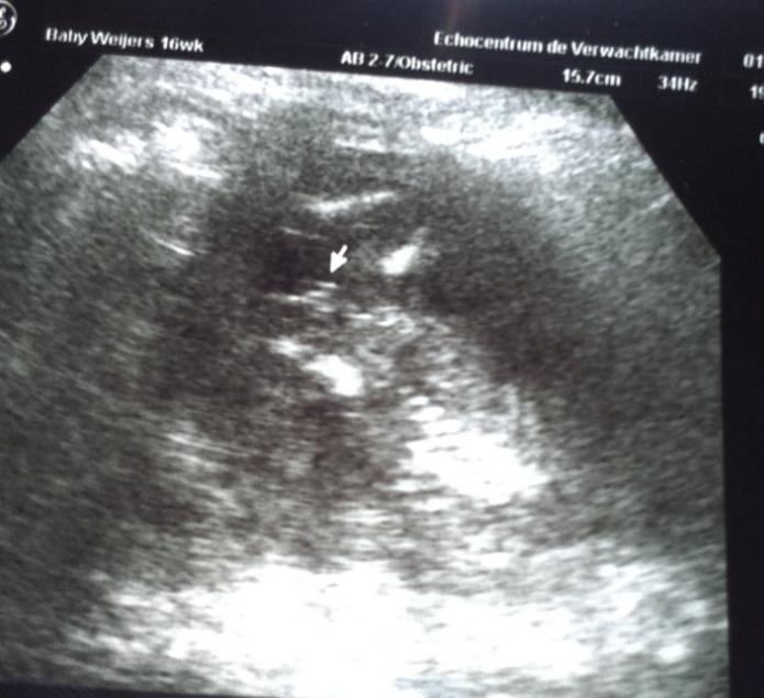 Name:  it's a girl!!.jpg
Views: 616
Size:  51.5 KB