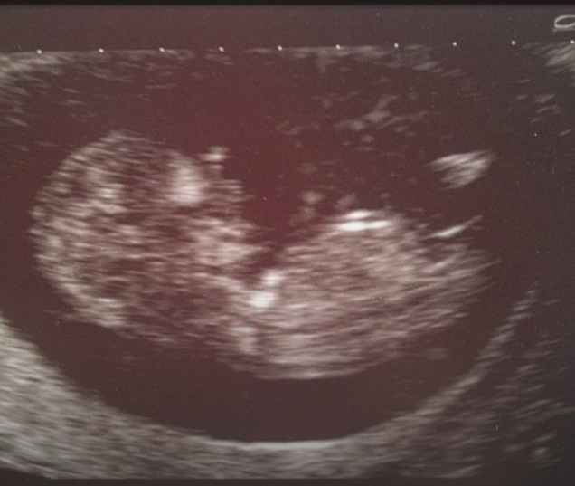 Name:  scan nub.jpg
Views: 239
Size:  68.4 KB