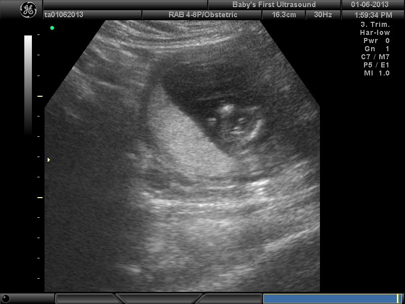 Name:  BABY_1.JPG
Views: 3960
Size:  141.0 KB