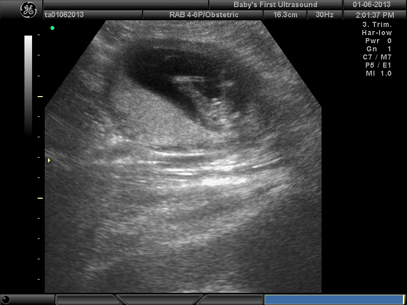 Name:  BABY_4.JPG
Views: 2628
Size:  146.2 KB